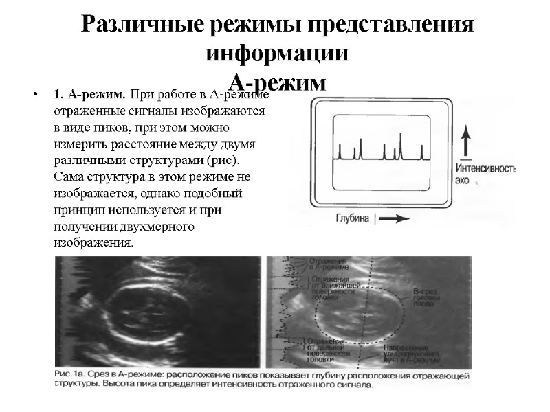 Различные режимы представления информации А-режим 1. А-режим. При работе в А-режиме отраженные сигналы изображаются